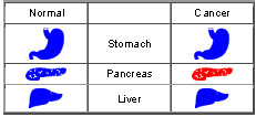 Genomics Science Project CGAP over-expression of CLASP2 in pancreas
