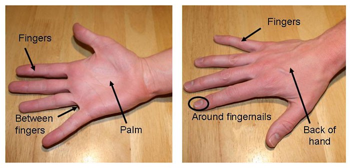 Side-by-side photos of the front and back of a hand labeled with fingers, palm, between fingers and fingernails