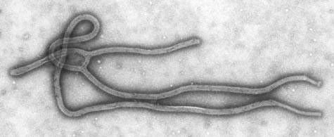 Microscopic image of a noodle like structure that is the Ebola virus