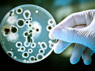 petri dish with bacteria