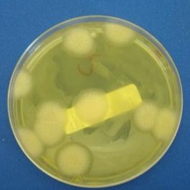 A visible colony of pink yeast in an agar plate