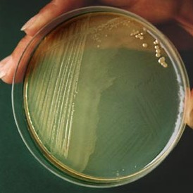 A visible colony of the bacteria Proteus vulgaris in an agar plate