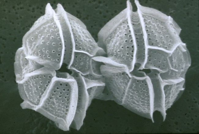 A scanning electron microscope image of dinoflgelates. 