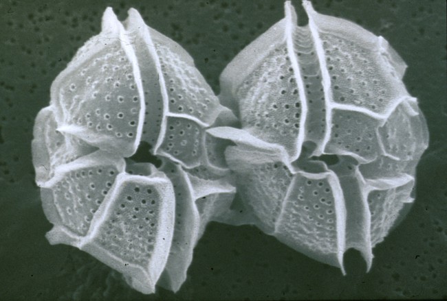 A scanning electron microscope image of dinoflgelates.