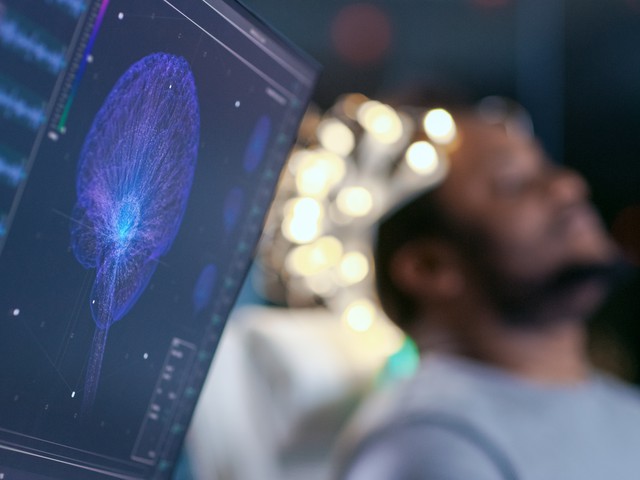 monitors showing eeg reading and graphical brain model in sleep study