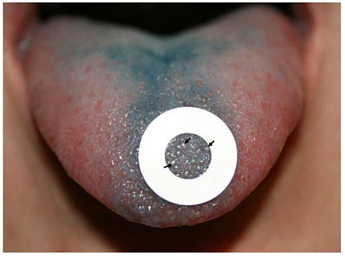 Do You Love The Taste Of Food Find Out If You Are A Supertaster