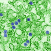 zika virus image