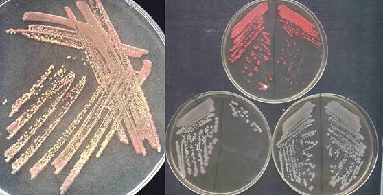 On the left, a close-up of a single agar plate streaked with bacteria.  On the right, three agar plates, each with quadrant streaks of three different types of bacteria. 
