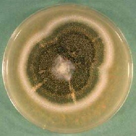 A visible colony of black mold in an agar plate