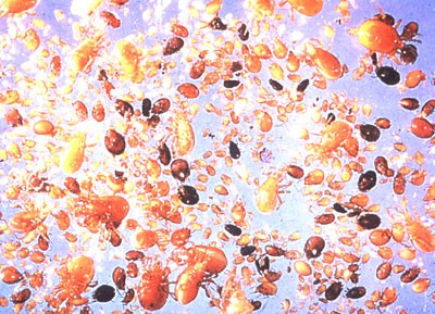 Microscopic image of hundreds of species of mites