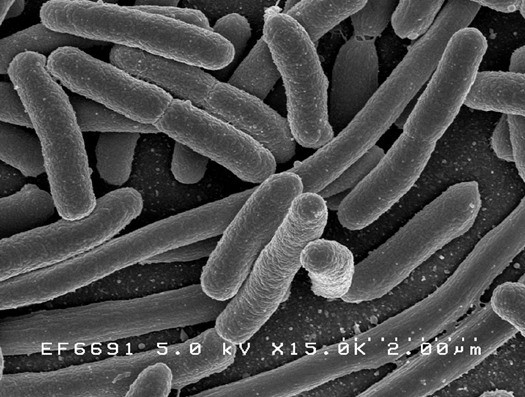 A scanning electron microscope image showing Escherichia coli bacteria.