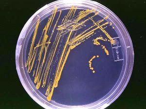 Agar plate showing colonies of yellow microorganisms