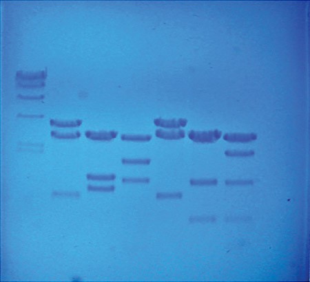 DNA fingerprints appear as dark blue lines in multiple columns on a light blue gel