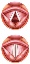 Drawing of vocal folds open above vocal folds which are closed