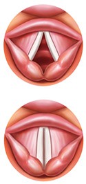 Drawing of vocal folds open above vocal folds which are closed