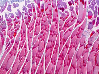 muscle tissue