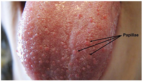 Close up photo of a human tongue shows small bumps on the surface called papillae