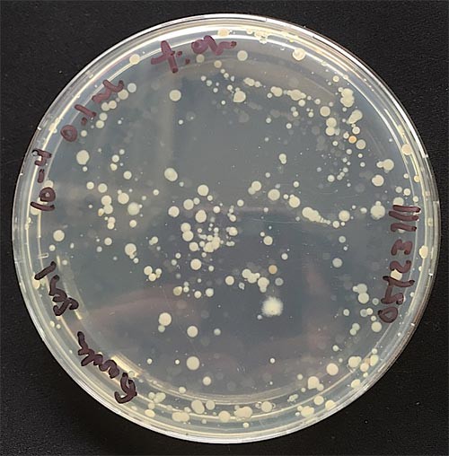 Bacteria colonies forming in small groups within an agar plate