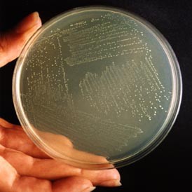 A visible colony of the bacteria Streptococcus pyogenes in an agar plate