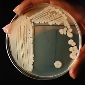 A visible colony of the bacteria Bacillus subtilis in an agar plate