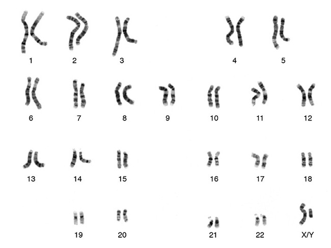 Karyotype showing all forty-six chromosomes of a human male.