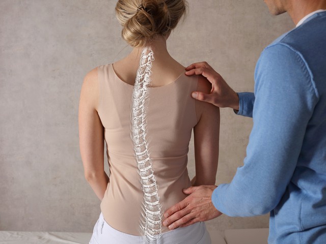 scoliosis