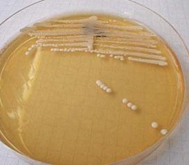 A visible colony of the yeast Candida Albicans in an agar plate