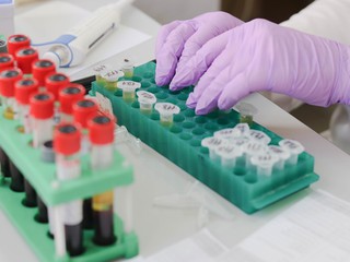 blood samples ready for laboratory