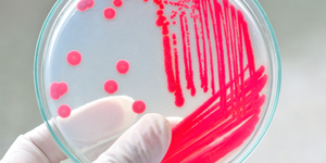 2014-blog-amgen-biotech-experience-bacteria-petri-300.png