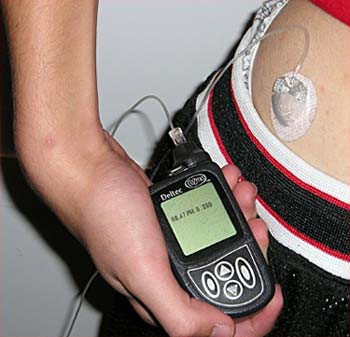 A person holds an insulin pump that is inserted into their waist area