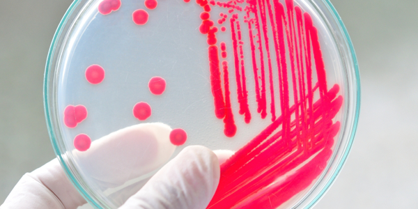 Amgen Biotech Experience Bacteria Petri / hands-on biotechnology