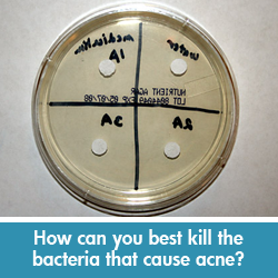 Kill acne-causing bacteria science project