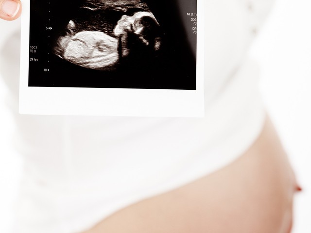 ultrasound of an expecting mother