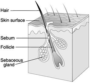 Diagram of a hair follicle and sebaceous gland