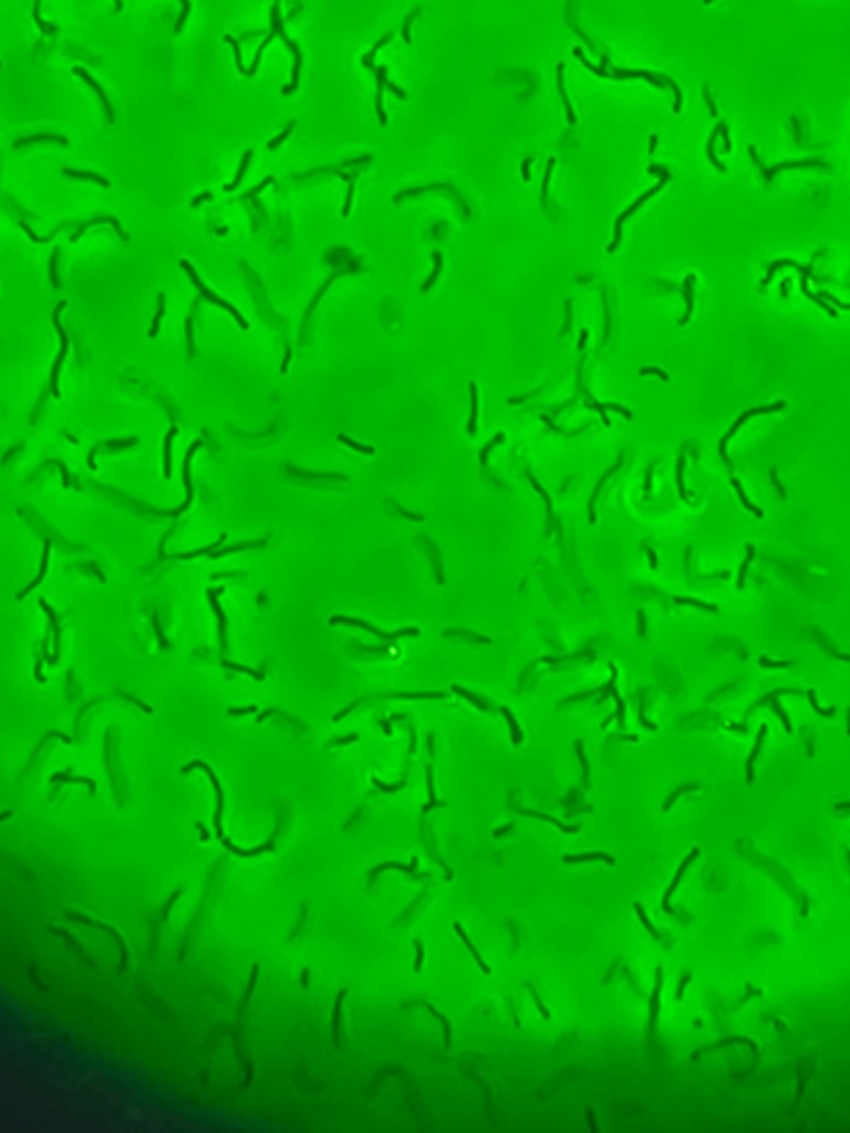 phase contrast