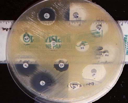 Bacteria in an agar plate avoids growing around circular inhibition zones created by small pieces of filter paper
