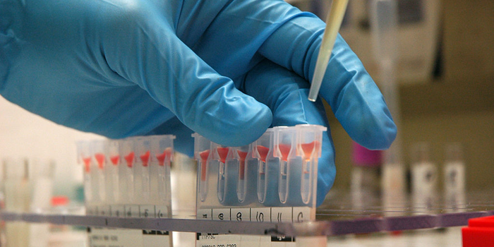 A pipette above vials of blood samples