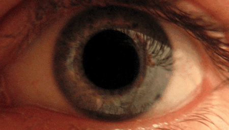  Gif showing the dilation and constriction of the pupil. 