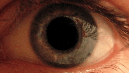 Gif showing the dilation and constriction of the pupil.
